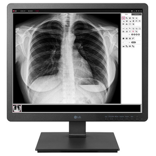 LG Digital Signage Displays Digital Signage Display